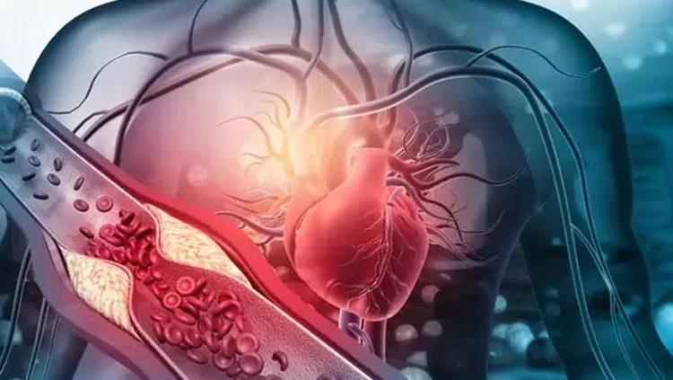 KOLESTEROLÜN BESLENME İLE İLİŞKİSİ VAR MI