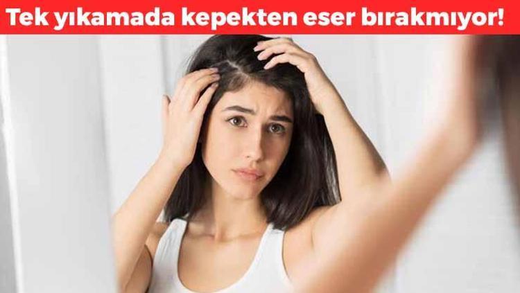 Saçtaki kepekten eser bırakmıyor Tek yıkamada kepeği yok ediyor, saç derisini iyileştirip canlandırıyor