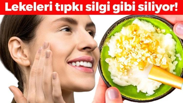 Ciltteki lekeleri silgi gibi siliyor 1 kaşık balla karıştırınca etkisi 10 katına çıkıyor, saçları ışıl ışıl yapıp yara ve yanıkları iyileştiriyor