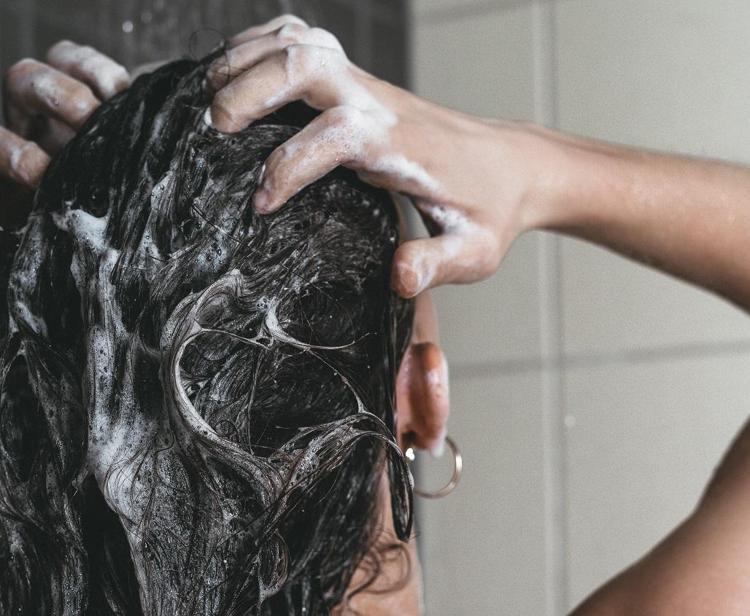 STRES VARSA KEPEK KAÇINILMAZ SON