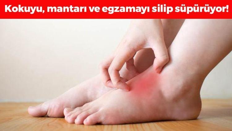 Koku, mantar ve egzamanın kökünü kazıyor Sadece 3 malzeme ile hazırlanıyor: Ayakları pamuk gibi yapıp kan dolaşımını artırıyor, nasıra en doğal çare