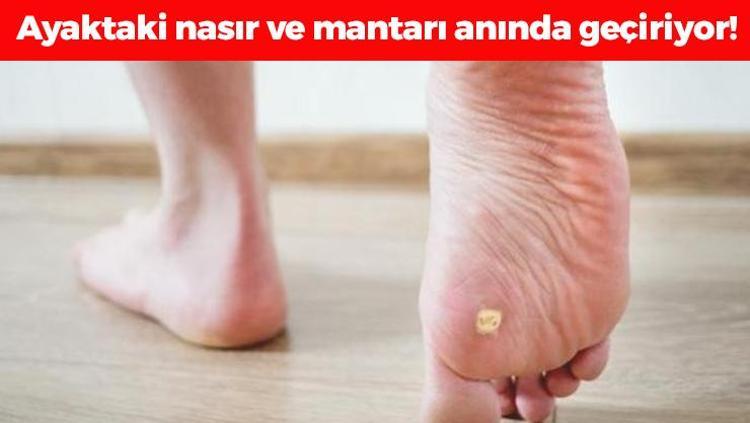 Nasırın ve egzamanın kökünü kazıyor Mantarı ve kokuyu geçiriyor, 1 hafta uygulamak yetiyor Bebek gibi pürüzsüz ayakların sırrı
