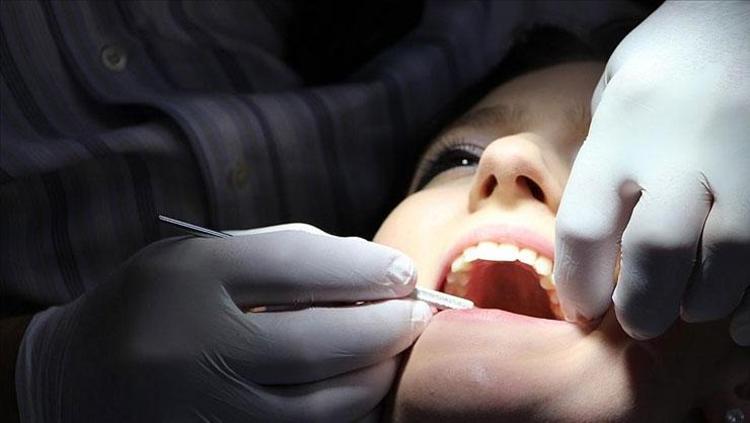 Diş çürümesini engelliyor Bu yöntemi mutlaka uygulayın: 6 ayda bir kuralı önem taşıyor