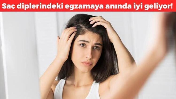 Egzamanın doğal ilacı Mantar ve egzamaya iyi geliyor, 1 kez kullanmak yeter: Gece sürüp sabaha kadar bekletince kaşıntının kökünü kurutuyor
