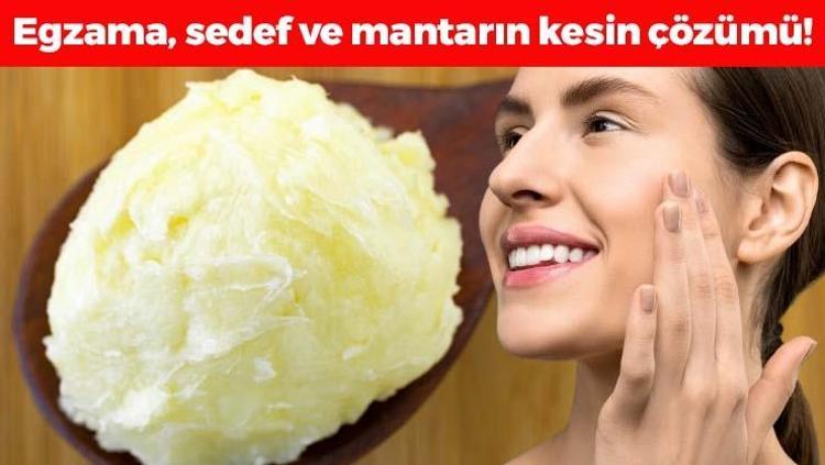 Egzama, mantar ve sedefin kökünü kazıyor Cildi nemlendirip 10 yaş birden gençleştiriyor, kuruluğa ve kızarıklara son veriyor