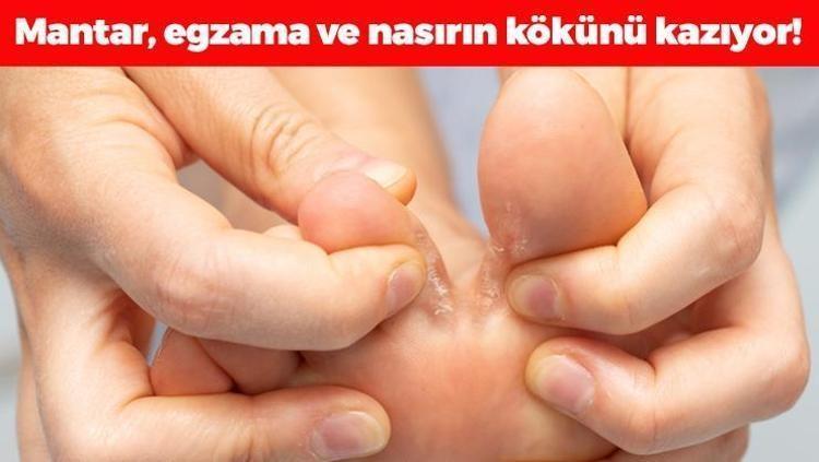 Nasırın kökünü kurutuyor Egzama, nasır ve mantarı tarihe gömüyor, ayakları pamuk gibi yumuşacık ve pürüzsüz yapıyor