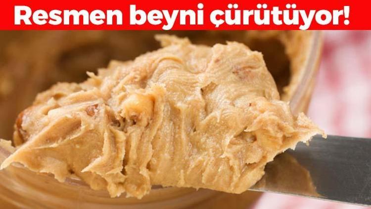 1 lokması bile beyni çürütüyor, ömrümüzden 10 yıl çalıyor Sağlıklı diye kaşık kaşık yiyoruz ama damar tıkanıklıklarının ve diyabetin en büyük sebebiymiş