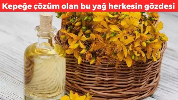 Kepek sorununa kesin çözüm Saçları parıl parıl parlatıyor, saç köklerini güçlendiriyor, saç dökülmesinden kurtarıyor