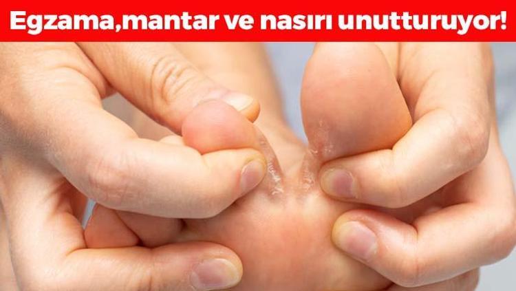 Nasırın kökünü kurutuyor Egzama, nasır ve mantarı tarihe gömüyor, ayakları pamuk gibi yumuşatıp pürüzsüzleştiriyor