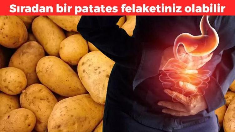 Bu patatesleri sakın yemeyin Felç ve halüsinasyonun kapınızı çalmasına sebep olabilir