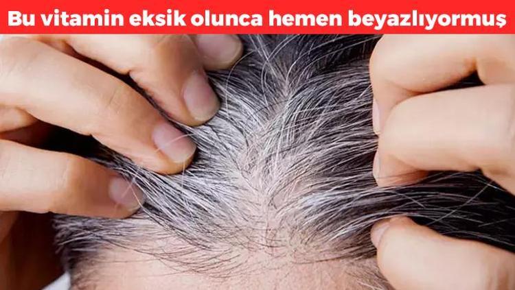 Beyaz saçların suçlusu bu eksiklikmiş Bu vitamin eksikse saçlar hızla beyazlıyor: Çözümü görenler şaşkına dönüyor