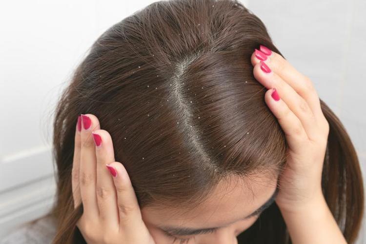 Günde 1 avuç tuzsuz tüketmek gerekiyor Saç sökülmesini anında durduruyor: Rapunzel gibi saçların sırrı meğer ondaymış