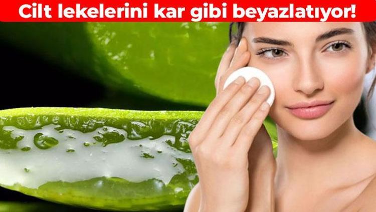 Lekeleri beyazlatan formül Cildi derinlemesine besliyor: 4 malzemeyle evde hazırlayabilirsiniz