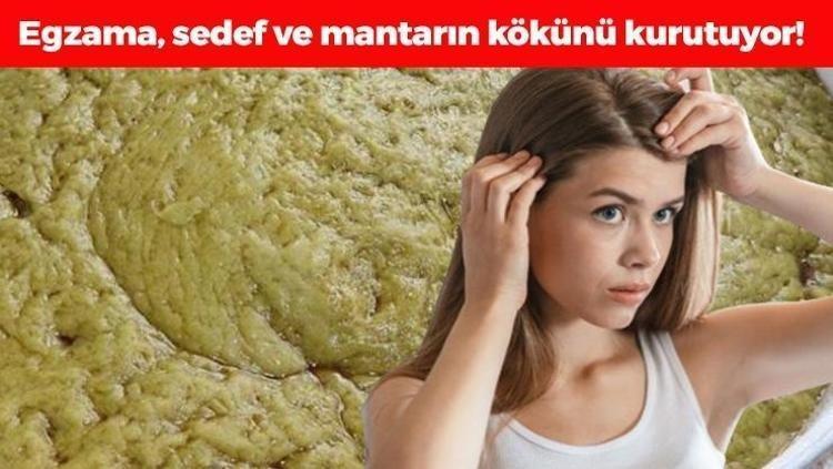 Tanesi 30 TLden satılıyor Egzama, sedef ve mantarın kökünü kazıyor, avuç avuç dökülen saçlara son veriyor Rapunzel gibi saçların sırrı