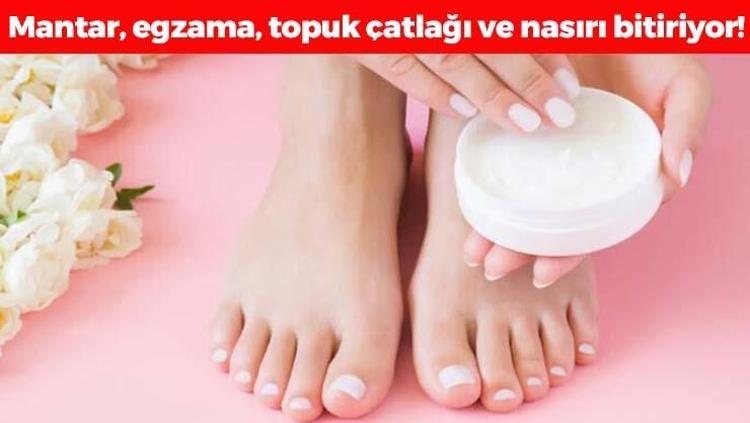 1 parça kullanmak yetiyor Çatlamış, kuru ve sertleşmiş ayak topuklarını 5 dakikada bebek gibi yumuşacık yapıyor Mantar, egzama ve nasırı da tarihe karıştırıyor
