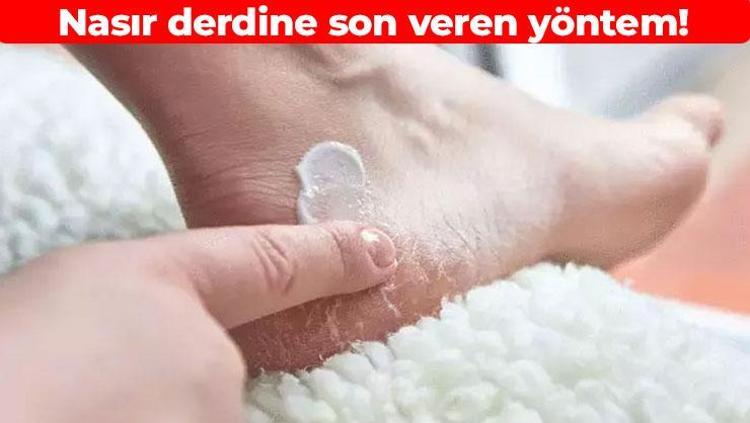 Nasırı 24 saatte yumuşatıp bitiriyor 3 malzemeyi karıştırıp sürün: Bebek gibi cilt için düzenli kullanın