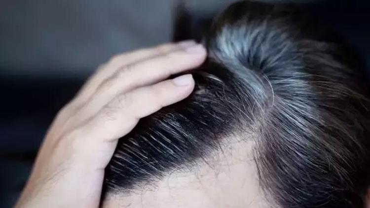 Beyaz saçları eski haline çeviriyor Saçları dipten uca güçlendiriyor: Doğal rengini geri kazandırıyor