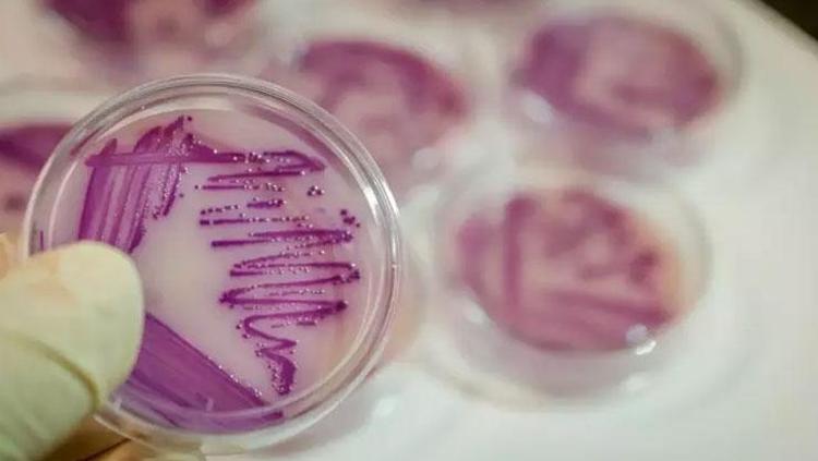 SALMONELLA VİRÜSÜ BULUNDU