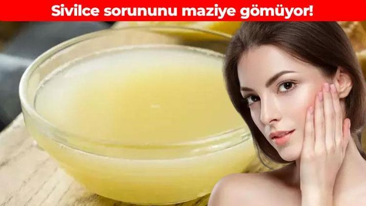 Sivilceye anında etki ediyor Cildi bebek gibi yapıyor: Yüzünüzdeki aşırı yağı vakum gibi çekiyor
