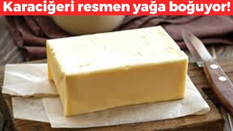 Karaciğeri yağa boğuyor Böbrekleri diyalizin pençesine düşürüyor: Pilava koyanlar yediğine bin pişman oluyor