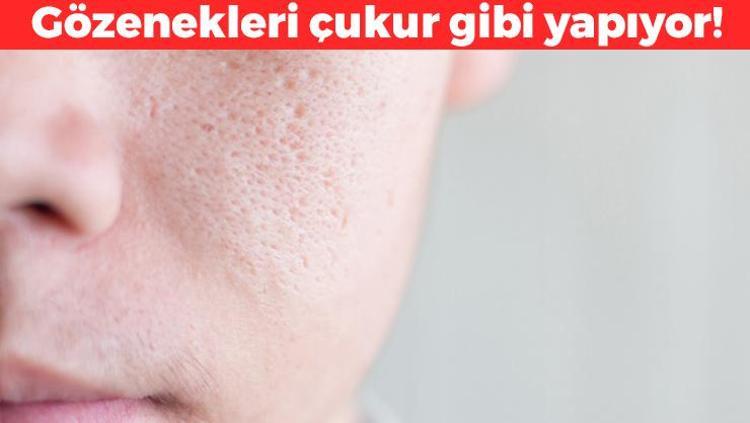 Cildi saniyesinde buruşturuyor Göz kapaklarını sarkıtıp gözenekleri nokta nokta yapıyor: 1 gecede 10 yaş yaşlandırıyor