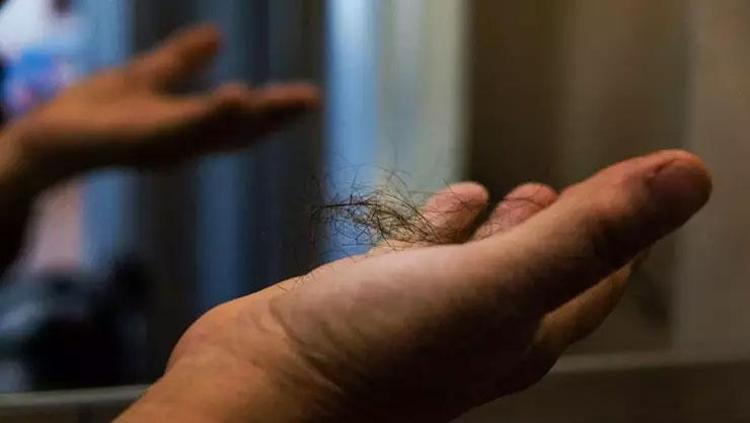Saç ekim uzmanlarını işsiz bırakıyor Bebek saçların çıkmasını sağlıyor: Avuç avuç dökülen saçlarınızı halat gibi güçlendirecek