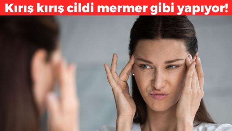 Kağıt gibi buruşmuş cildi kolajene boğuyor Mermer gibi cilt isteyenler denesin, botoksa para dökmeyin