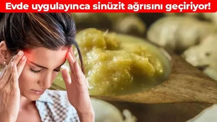 Sinüzitin doğal ilacı Tıkalı sinüsleri anında boşaltıyor: Baş ağrısını saniyeler içerisinde geçiriyor