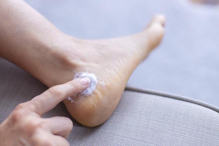 Nasırın kökünü kurutuyor Mantar ve egzamayı 1 günde geçiriyor, 10 dakika bekletince ayakları pamuk gibi yapıyor, sadece 2 malzemeyle yapılıyor