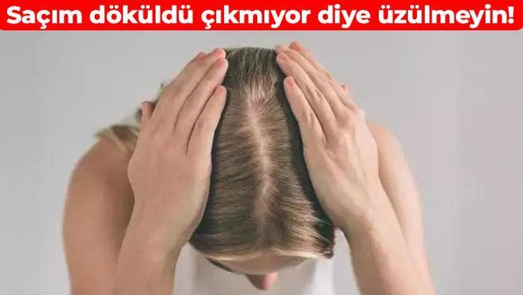 Aynı gün saç çıkarmaya başlıyor Kelleşme problemini tarihe karıştırıyor