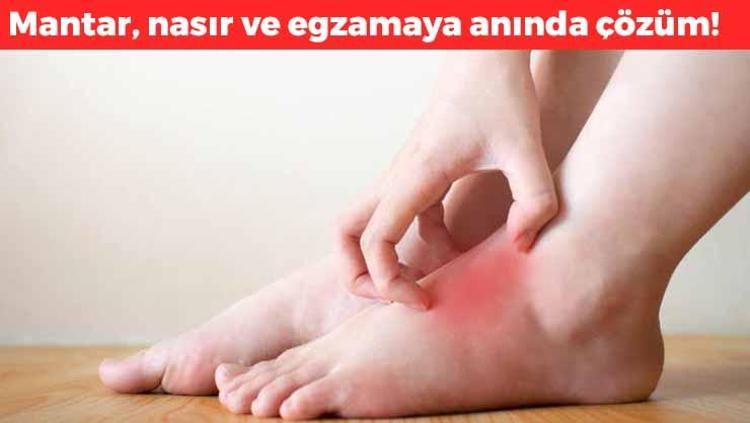 Mantarı anında bitiriyor Ayakları yumuşacık yapıyor: Nasır, mantar ve egzamanın kökünü kurutuyor