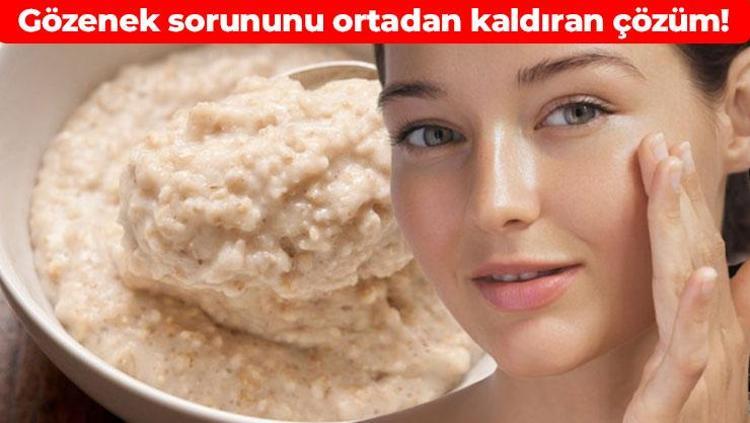 Kahverengi lekelerin kökünü kazıyor Cildi ay gibi parlatıyor: Gözeneklerin içini dolduruyor