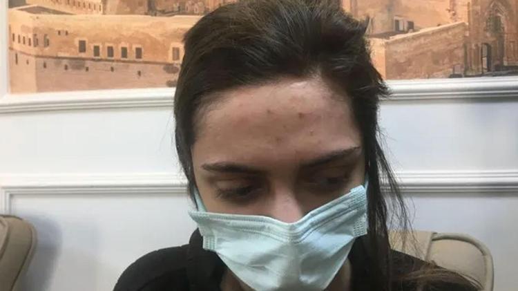 Rezidansta işkence Saçını kesip, vücudunda sigara söndürdü, cezası kesinleşti