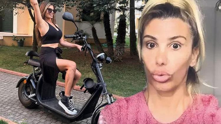 Hatice botoks zehirlenmesi yaşadı, kadınları uyardı