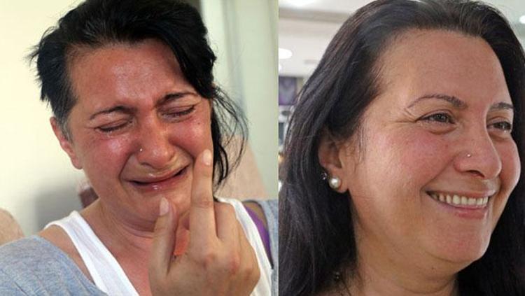 32 DİŞİ BİRDEN ÇEKTİREN AĞRI