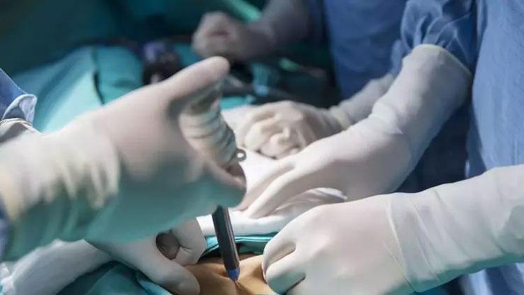 Dünyada 100 bin kişide 1 görülüyor İç organları ters doğmuştu: Fazla kilolarından böyle kurtuldu