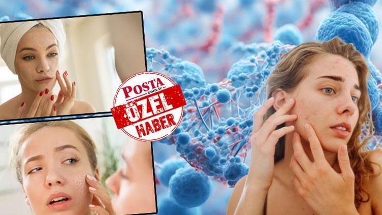 Cilt bakım maskesinde salmonella tehlikesi Dermatoloji uzmanı sosyal medya tuzağına karşı uyardı