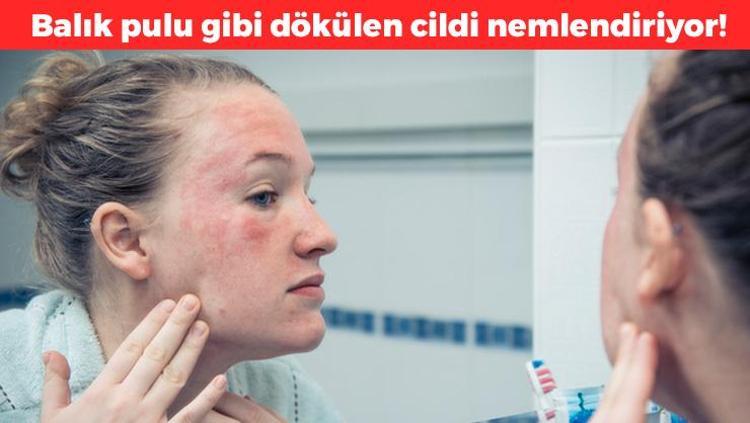 Balık pulu gibi dökülen cildi mermere çeviriyor Nem bombası maske: Sadece 2 malzemeyle hazırlanıyor