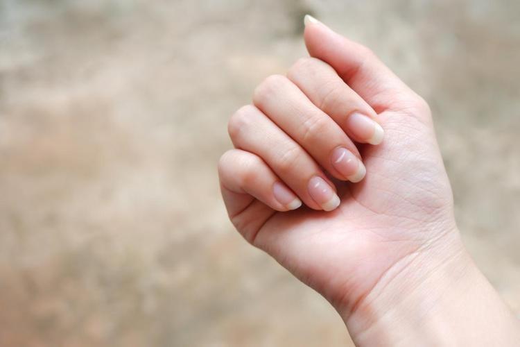 SİYAH LUNULA