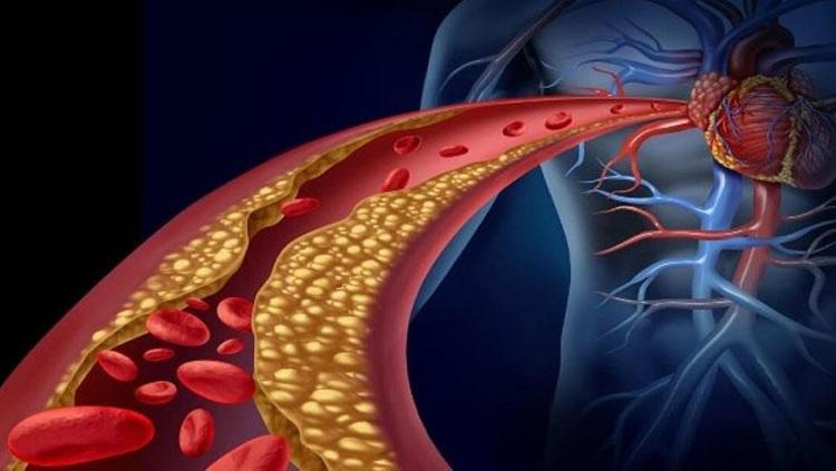 Yüksek kolesterol hastaları sofrasından eksik etmesin Damarları tertemiz yapıyor