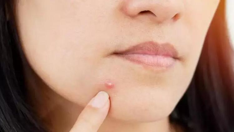 KORTİZOL HORMONUNA DİKKAT