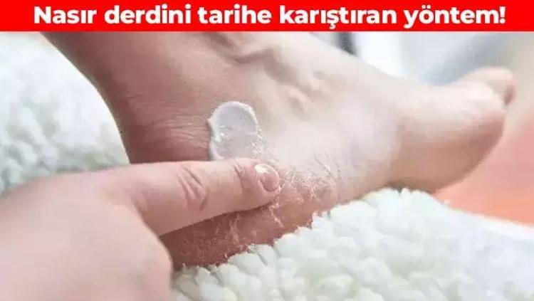 Nasırı 24 saatte yumuşatıp bitiriyor 3 malzemeyi karıştırıp sürün: Yumuşacık cilt için düzenli kullanın