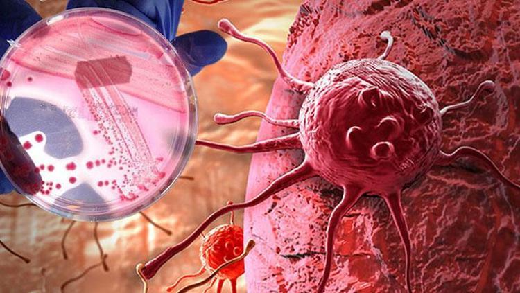 Korkulu rüyanın şifreleri çözülüyor Erken teşhis için yapak zekanın kritik önemi