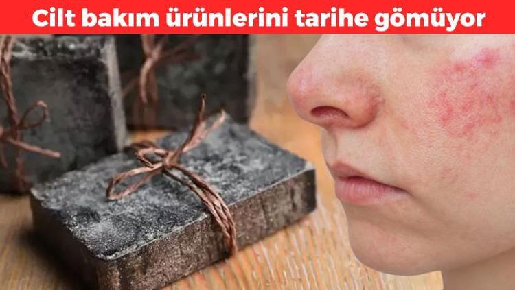Kimyasal bakım ürünlerini çöpe attırıyor Bir kere deneyen bırakamıyor: Sivilce ve iltihabın kökünü kurutuyor, saç köklerine doping yapıyor