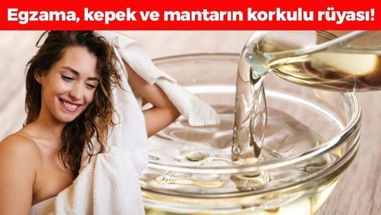Saçtaki kepek, mantar ve egzamanın kökünü kurutuyor, 1 ayda 5 santim uzatıyor En pahalı kremlerden bile daha etkili: 1 kaşığı saçları ışıl ışıl parlatıyor