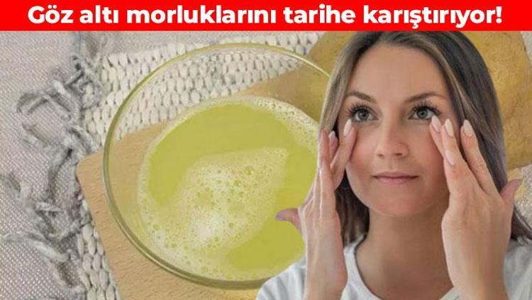 Estetisyenler sır gibi saklıyor Işık dolgusu öncesi son çıkış: Göz altı morluklarını silip süpürüyor, kazayaklarını santim santim açıyor