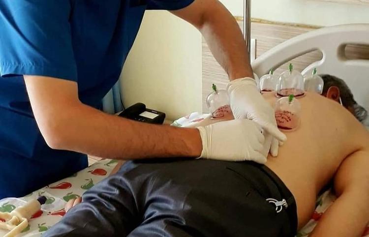 Haziran ayı hacamat günleri nelerdir 2025 Hacamat tarihleri, altın günler ne zaman Haziran ayı hacamat tarihleri