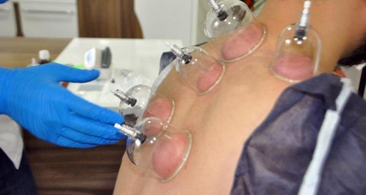 Haziran ayı hacamat günleri nelerdir 2025 Hacamat tarihleri, altın günler ne zaman Haziran ayı hacamat tarihleri