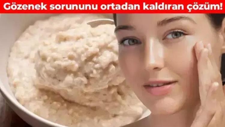 Kahverengi lekelerin kökünü kazıyor Cildi ay gibi parlatıyor: Gözeneklerin içini dolduruyor