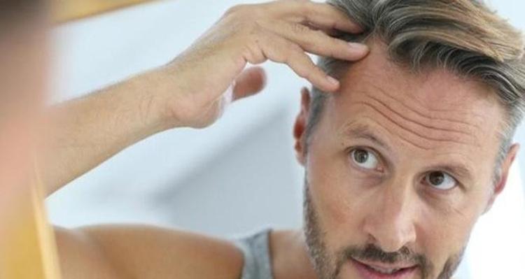 Saçları genç yaşta döküyor Kelleşmeye neden oluyor: Her şampuan aynı diye kullanıp geçmeyin